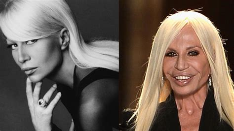 versace serie donatella|Donatella Versace before and after surgery.